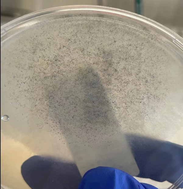 顯微鏡下的霉菌 顯微鏡下的霉菌